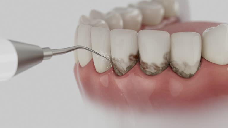 Reliable Dental contractor in Vincennes, IN by Dentist Open Now